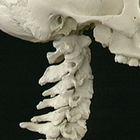 Whiplash and Central Ligament Sprains 